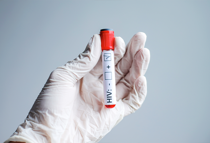 Why Is It Important to Have a Hepatitis Test Before Hair Transplantation?