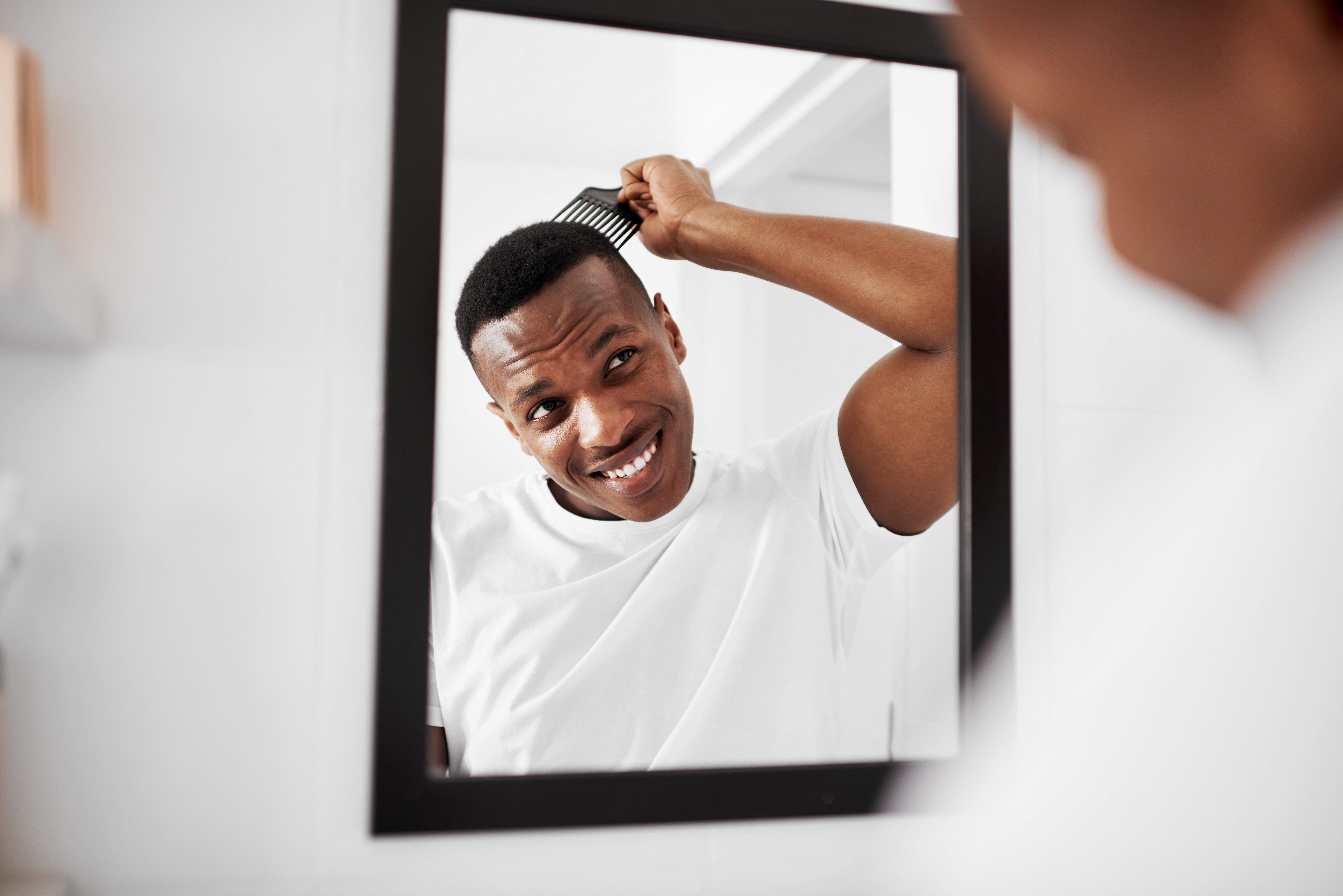 How Long Should You Wait to Style Your Hair After Afro Hair Transplantation?